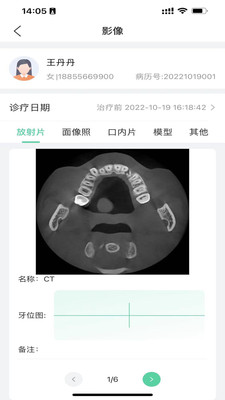 美亚美牙收费价格明细与矫正复诊记录展示