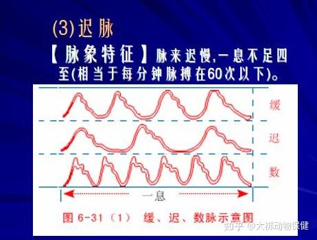 识脉 浮沉迟数四种基本脉象对比讲解图