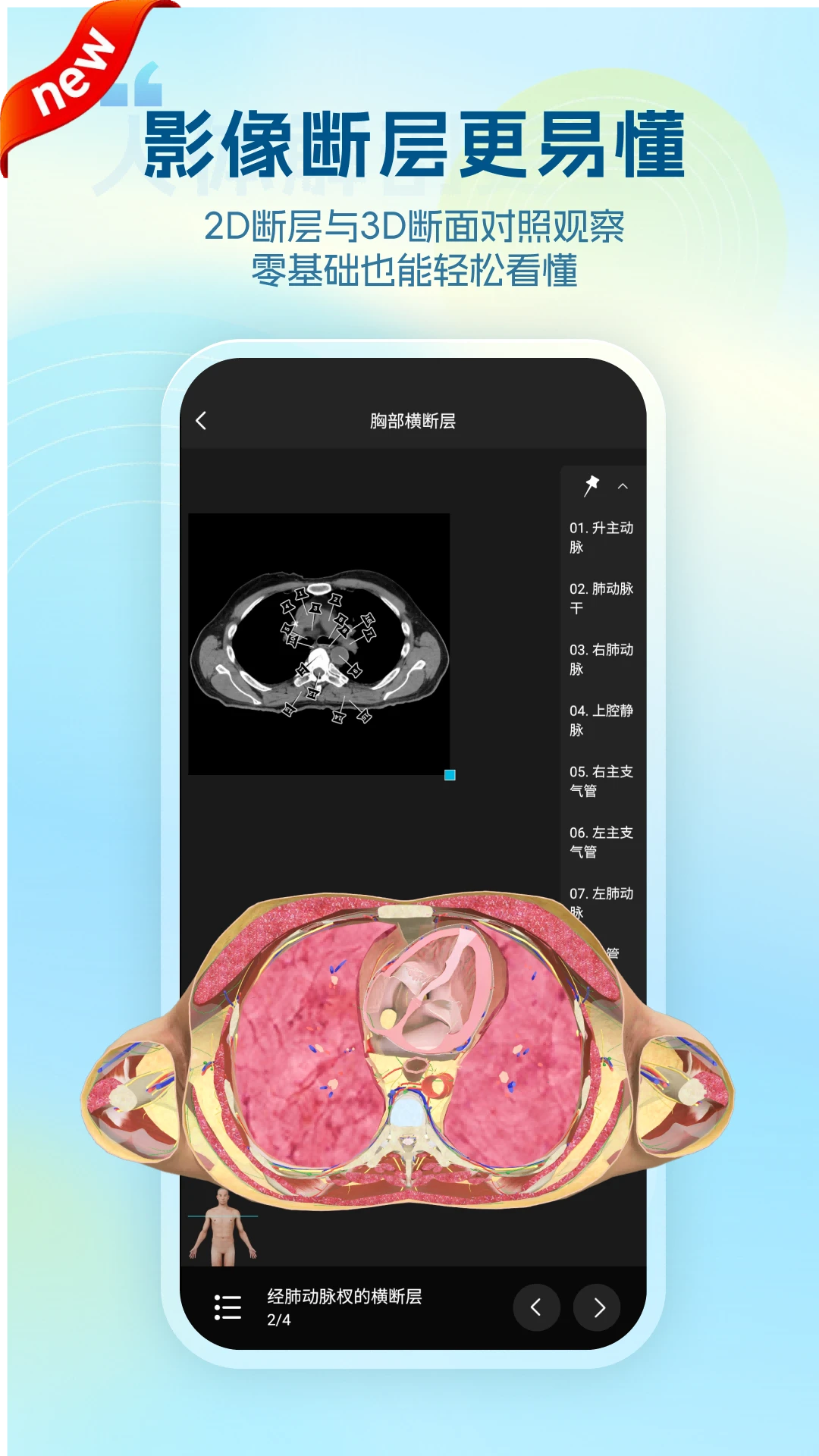 ά����3D����Vesal7.1.1 ��ά�������ѧϰ