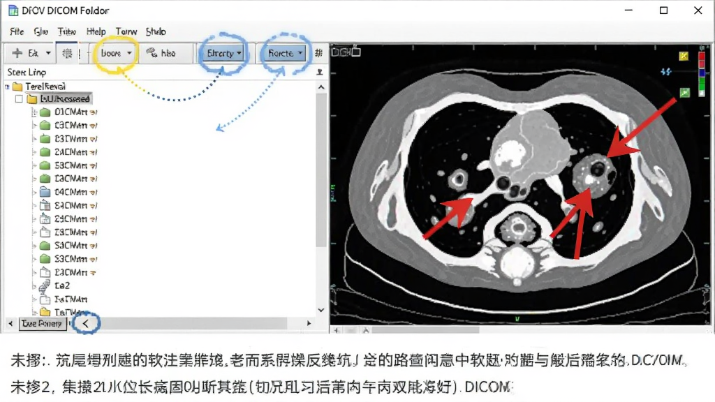 主体为软件操作教程示意图,屏幕截图显示打开DICOM文件夹后的主界面,左侧有序列列表,右侧为CT图像,图像上有红色箭头指向病灶区域。布局为教学风格,在图像下方有步骤文字说明。排版清晰,风格为实用教程截图。细节上,界面高亮显示关键按钮位置,画质干净,无多余元素。