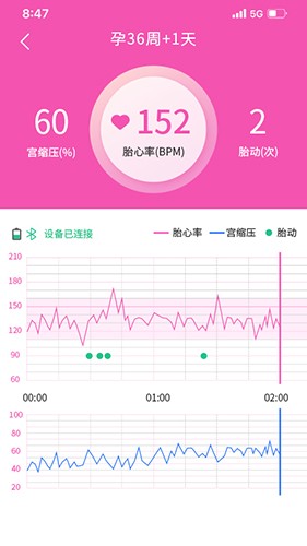 乖乖葆孕妇 安卓版 胎心监护界面截图