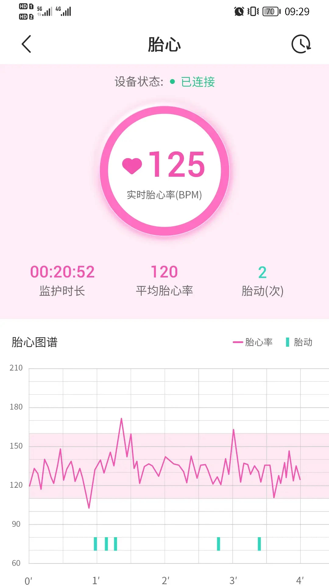 �Թ����и�1.3.40 ̥�ļ໤����